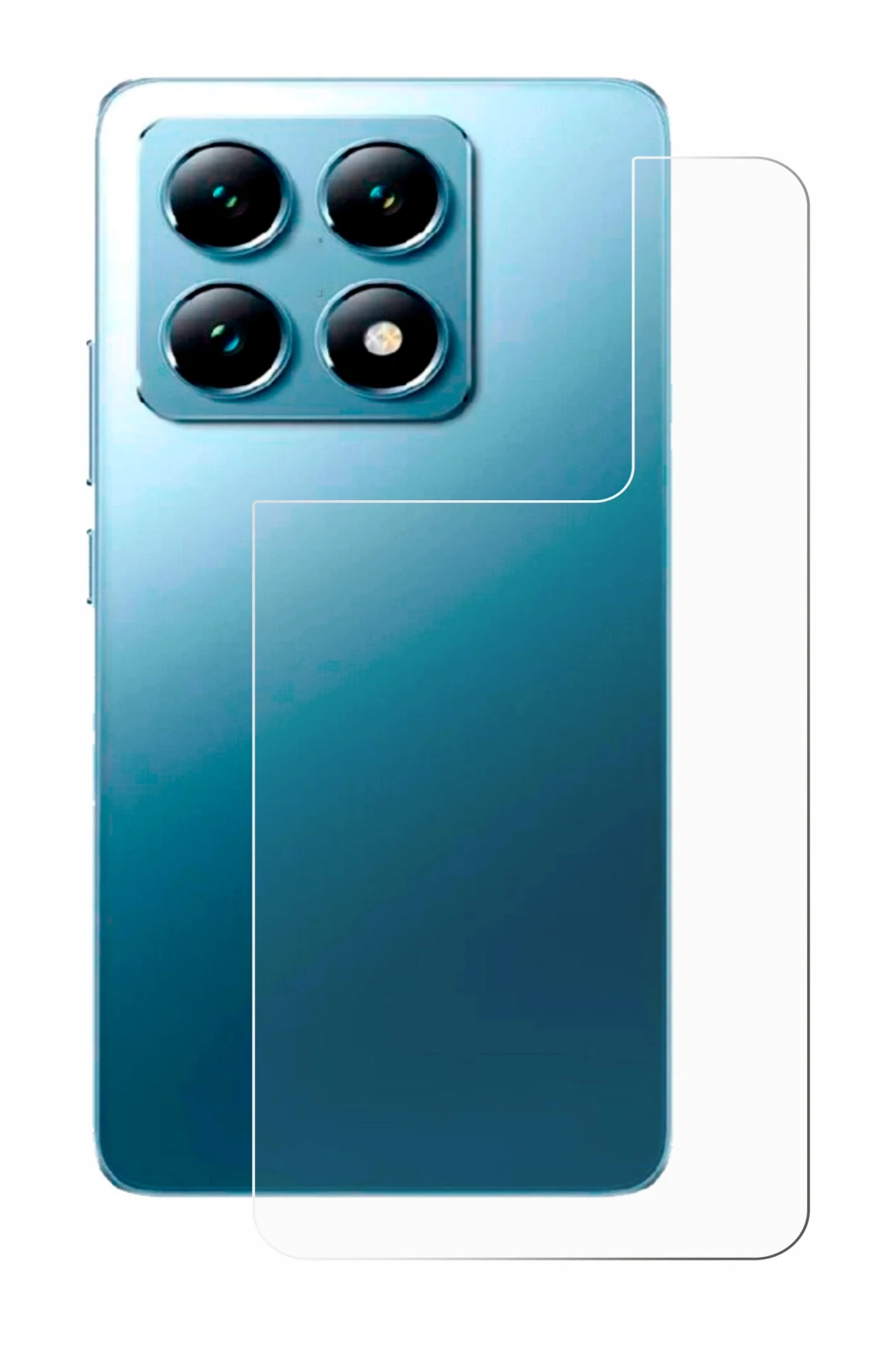 Image of the device Xiaomi 14T (Back) with a wide variety of screen protectors.