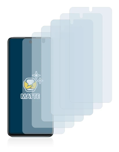 Image of the device Xiaomi Redmi Note 11S 5G with a wide variety of screen protectors.