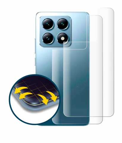 Image of the device Xiaomi 14T Pro (Back) with a wide variety of screen protectors.