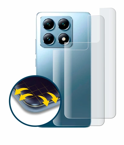 Image of the device Xiaomi 14T Pro (Back) with a wide variety of screen protectors.