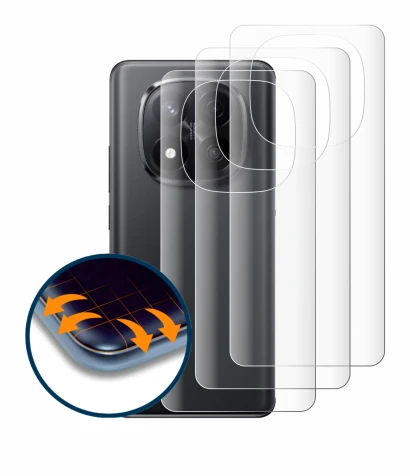 Image of the device Xiaomi Redmi Note 14 Pro Plus (Back) with a wide variety of screen protectors.