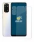 Image of the device Xiaomi Redmi Note 11S (Front+Camera) with a wide variety of screen protectors.