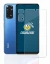 Image of the device Xiaomi Redmi Note 11 (Front+Camera) with a wide variety of screen protectors.