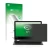 Front side of a product packaging with the brand logo upscreen. Next to it is the device MEDION Akoya E2215T (MD 60256) shown 