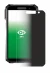 Image of the device Soyes S10 Max with a wide variety of screen protectors.