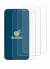 Image of the device Huawei Nova 15 with a wide variety of screen protectors.